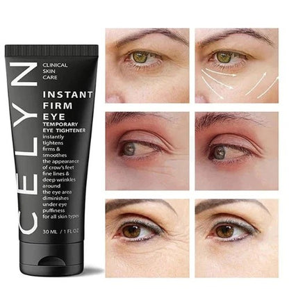 Celyn™ Eye Cream
